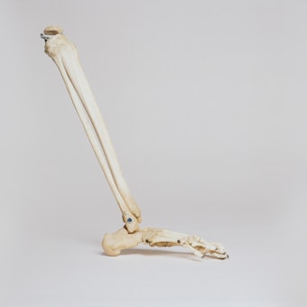  Natural Relief for Stiff Joints & Pain